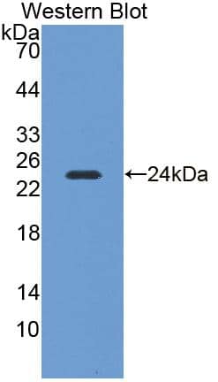 Western Blot NEI3 Antibody