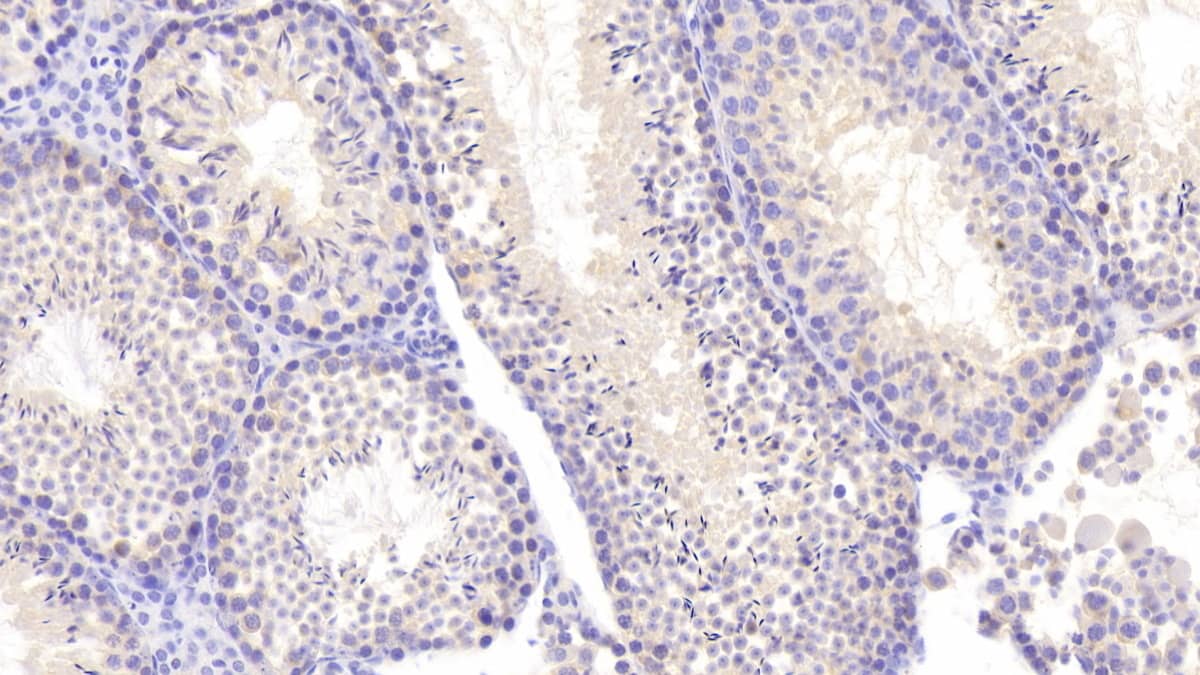 Immunohistochemistry-Paraffin NEI3 Antibody