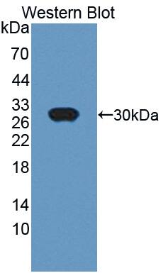 Western Blot: UCH-L4 Antibody [NBP3-42058] - Sample: Recombinant UCH-L4, Mouse.