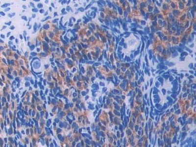 Immunohistochemistry-Paraffin UMODL1 Antibody