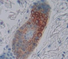 Immunohistochemistry-Paraffin: KRT25 Antibody [NBP3-42061] - Used in DAB staining on fromalin fixed paraffin- embedded Kidney tissue