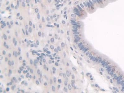 Immunohistochemistry-Paraffin: HPS1 Antibody [NBP3-42062] - DAB staining on IHC-P; Samples: Mouse Uterus Tissue; Primary Ab: 30ug/ml NBP3-42062