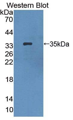 Western Blot: HPS1 Antibody [NBP3-42062] - Sample: Recombinant protein.