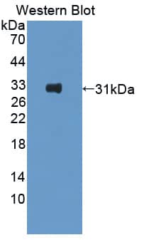 Western Blot: Contactin-6 Antibody [NBP3-42066] - Sample: Recombinant protein.