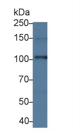 Western Blot: Contactin-6 Antibody [NBP3-42066] - Sample: Mouse Cerebrum lysate; Primary Ab: 3ug/ml NBP3-42066; Second Ab: 0.2ug/mL HRP-Linked Caprine Anti-Rabbit IgG Polyclonal Antibody