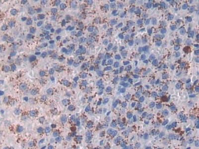 Immunohistochemistry-Paraffin: MBP-1 Antibody (C11) [NBP3-42067] - DAB staining on IHC-P; Sample: Rat Adrenal gland Tissue; Primary Ab: 30ug/ml NBP3-42067; Second Ab: 2ug/mL HRP-Linked Caprine Anti-Mouse IgG Polyclonal Antibody