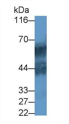 Western Blot: Cytokeratin 71 Antibody [NBP3-42068] - Sample: Mouse Skin lysate Primary Ab: 0.5ug/ml NBP3-42068; Second Ab: 0.2ug/mL HRP-Linked Caprine Anti-Rabbit IgG Polyclonal Antibody