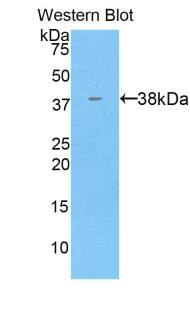 Western Blot: Cytokeratin 71 Antibody [NBP3-42068] - Sample: Recombinant protein.