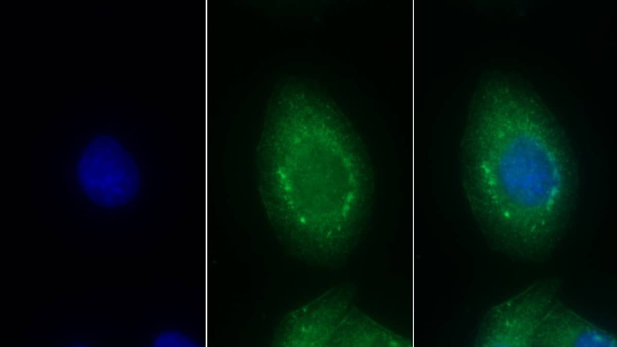 Immunocytochemistry /Immunofluorescence: Endothelin-1 Antibody (5#) [NBP3-42072] - FITC staining on IF; Sample: Human Hela cell; Primary Ab: 30ug/ml NBP3-42072; Second Ab: 2ug/ml FITC-Linked Caprine Anti-Mouse IgG Polyclonal Antibody