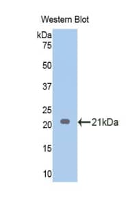 Western Blot: Endothelin-1 Antibody (5#) [NBP3-42072] - Sample: Recombinant protein.