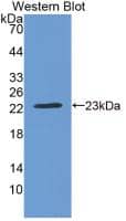 Western Blot CRYBB2 Antibody (6#)