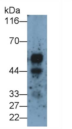 Western Blot: KiSS1R/GPR54 Antibody (D12) [NBP3-42076] - Sample: Rat Colon lysate Primary Ab: 0.4ug/ml NBP3-42076; Second Ab: 0.2ug/mL HRP-Linked Caprine Anti-Mouse IgG Polyclonal Antibody