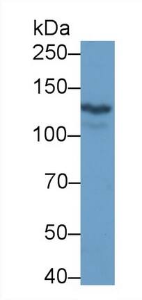 Western Blot: Ret Antibody (C1) [NBP3-42078] - Sample: K562 cell lysate Primary Ab: 3ug/ml NBP3-42078; Second Ab: 0.2ug/mL HRP-Linked Caprine Anti-Rabbit IgG Polyclonal Antibody