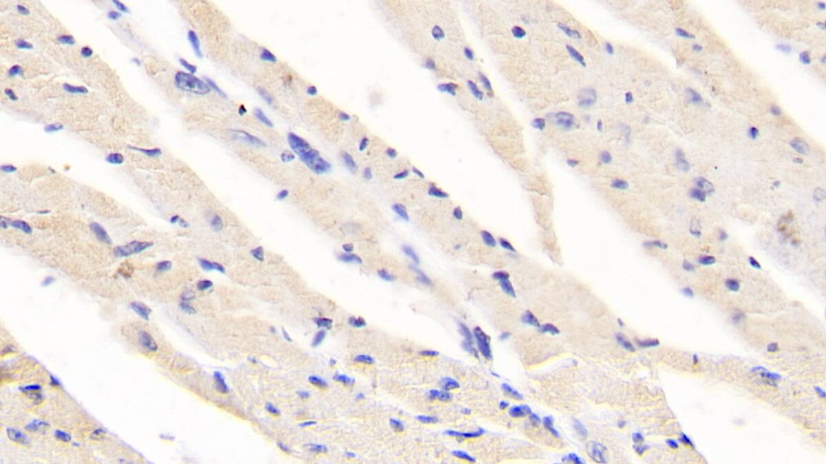 Immunohistochemistry-Paraffin: Ret Antibody (C1) [NBP3-42078] - DAB staining on IHC-P; Sample: Mouse Cardiac Muscle Tissue; Primary Ab: 20ug/ml NBP3-42078; Second Ab: 2ug/mL HRP-Linked Caprine Anti-Mouse IgG Polyclonal Antibody