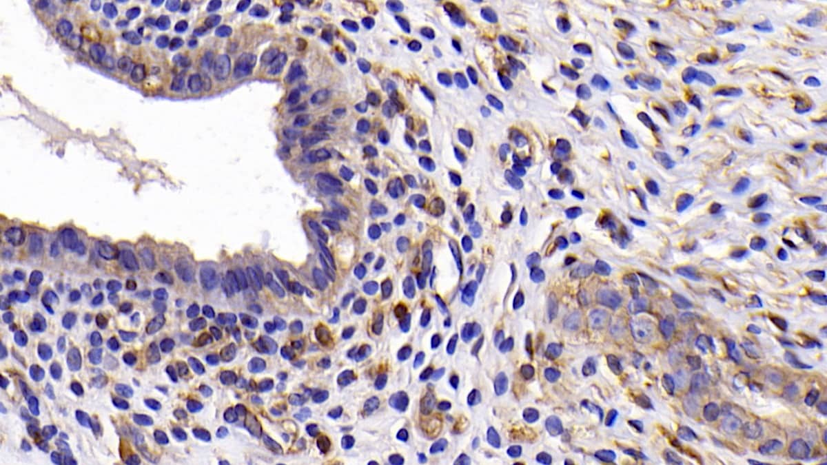 Immunohistochemistry-Paraffin: Bcl-xL Antibody (C4) [NBP3-42083] - DAB staining on IHC-P; Samples: Rat Uterus Tissue; Primary Ab: 30ug/ml NBP3-42083; Second Ab: 2ug/mL HRP-Linked Caprine Anti-Mouse IgG Polyclonal Antibody