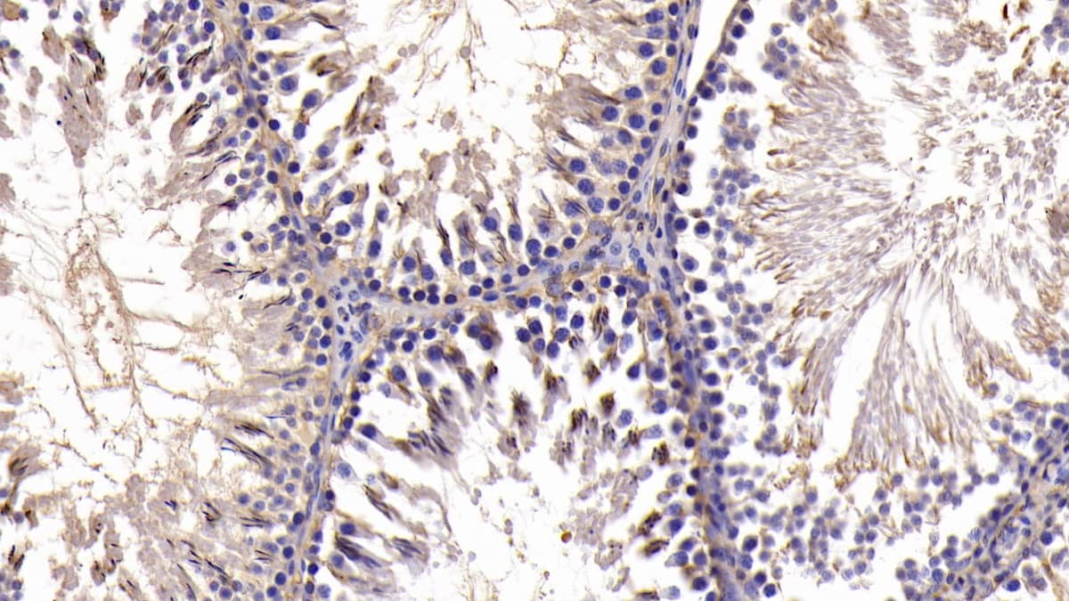 Immunohistochemistry-Paraffin: Bcl-xL Antibody (C4) [NBP3-42083] - DAB staining on IHC-P; Samples: Rat Testis Tissue; Primary Ab: 30ug/ml NBP3-42083; Second Ab: 2ug/mL HRP-Linked Caprine Anti-Mouse IgG Polyclonal Antibody