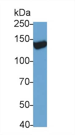Western Blot: TRPM4 Antibody (C1) [NBP3-42084] - Sample: Rat Serum Primary Ab: 0.5ug/ml NBP3-42084; Second Ab: 0.2ug/mL HRP-Linked Caprine Anti-Mouse IgG Polyclonal Antibody