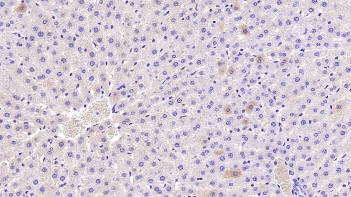 Immunohistochemistry-Paraffin: CRAT Antibody (C2) [NBP3-42085] - DAB staining on IHC-P; Samples: Rat Liver Tissue; Primary Ab: 40ug/ml NBP3-42085; Second Ab: 2ug/mL HRP-Linked Caprine Anti-Mouse IgG Polyclonal Antibody