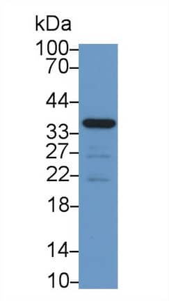 Western Blot: CRHBP Antibody (C11) [NBP3-42086] - Sample: Rat Heart lysate Primary Ab: 2ug/ml NBP3-42086; Second Ab: 0.2ug/mL HRP-Linked Caprine Anti-Mouse IgG Polyclonal Antibody