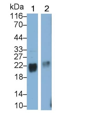 Western Blot: Stathmin-2/STMN2 Antibody [NBP3-42093] - Sample: Lane1: Porcine Cerebrum lysate; Lane2: Rat Cerebrum lysate Primary Ab: 0.1ug/ml NBP3-42093; Second Ab: 0.2ug/mL HRP-Linked Caprine Anti-Rabbit IgG Polyclonal Antibody