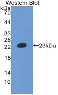 Western Blot: Hemoglobin epsilon Antibody (D4) [NBP3-42094] - Recombinant Chicken Hemoglobin epsilon