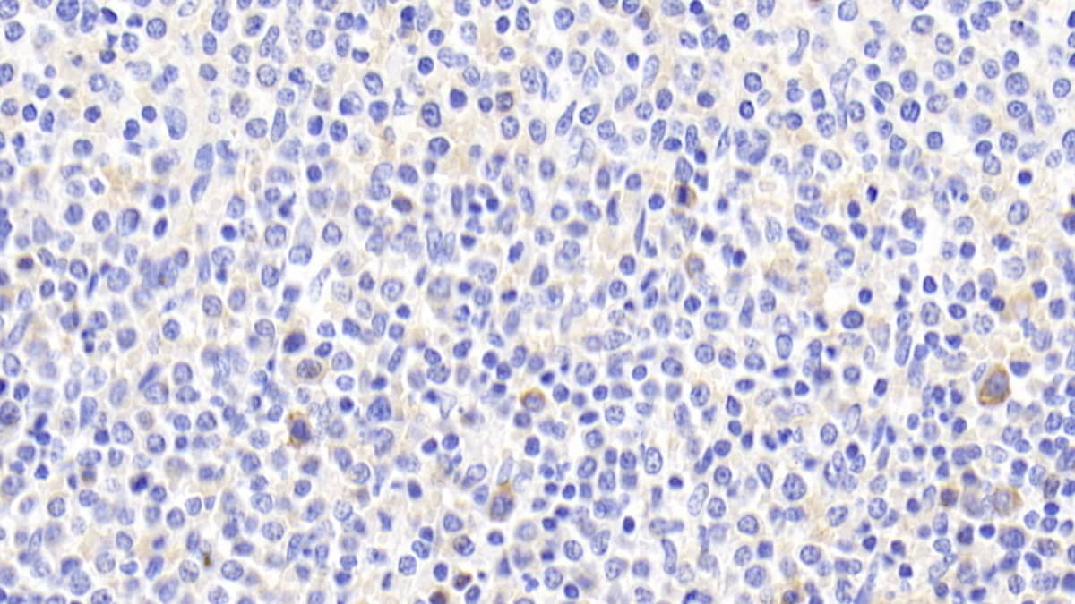 Immunohistochemistry-Paraffin: ABCA7 Antibody [NBP3-42095] - DAB staining on IHC-P; Samples: Human Spleen Tissue; Primary Ab: 20ug/ml NBP3-42095; Second Ab: 2ug/mL HRP-Linked Caprine Anti-Rabbit IgG Polyclonal Antibody