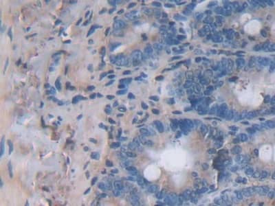 Immunohistochemistry-Paraffin: IL-24 Antibody (C1) [NBP3-42098] - DAB staining on IHC-P; Samples: Rat Small intestine Tissue; Primary Ab: 30ug/ml NBP3-42098