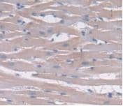 Immunohistochemistry-Paraffin: IL-24 Antibody (C1) [NBP3-42098] - DAB staining on IHC-P; Samples: Rat Heart Tissue