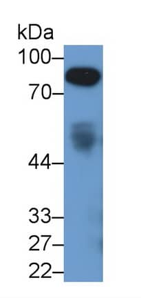 Western Blot: Afamin Antibody (C1) [NBP3-42099] - Sample: Rat Serum Primary Ab: 2ug/ml NBP3-42099; Second Ab: 0.2ug/mL HRP-Linked Caprine Anti-Mouse IgG Polyclonal Antibody