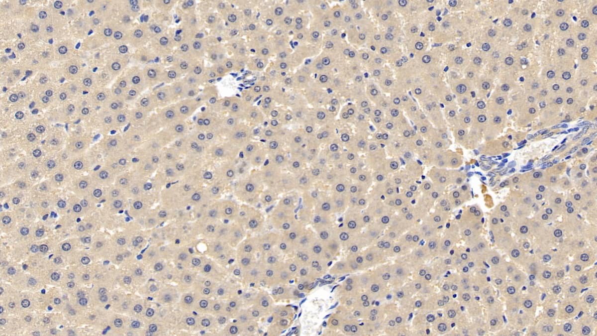 Immunohistochemistry-Paraffin: IGFBP-5 Antibody (C1) [NBP3-42100] - DAB staining on IHC-P; Samples: Rat Liver Tissue; Primary Ab: 20ug/ml NBP3-42100; Second Ab: 2ug/mL HRP-Linked Caprine Anti-Mouse IgG Polyclonal Antibody