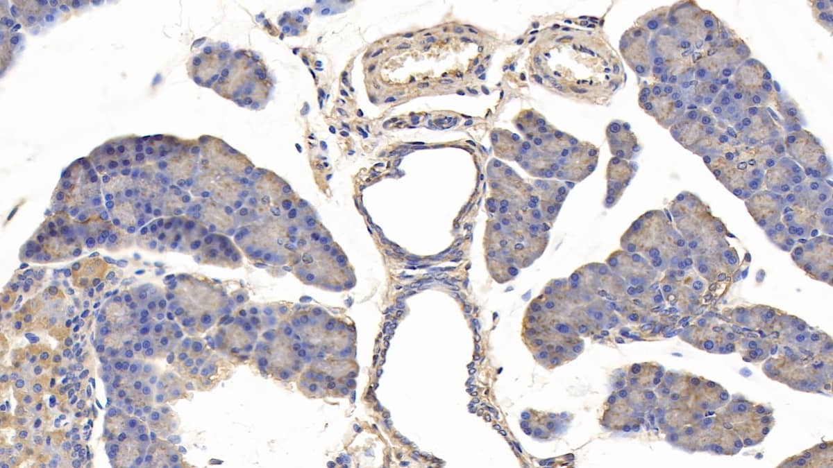 Immunohistochemistry-Paraffin: IGFBP-5 Antibody (C1) [NBP3-42100] - DAB staining on IHC-P; Samples: Rat Pancreas Tissue; Primary Ab: 20ug/ml NBP3-42100; Second Ab: 2ug/mL HRP-Linked Caprine Anti-Mouse IgG Polyclonal Antibody