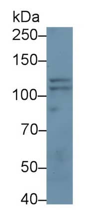 Western Blot: Neuropilin-2 Antibody (D15) [NBP3-42101] - Sample: Jurkat cell lysate Primary Ab: 3ug/ml NBP3-42101; Second Ab: 0.2ug/mL HRP-Linked Caprine Anti-Mouse IgG Polyclonal Antibody