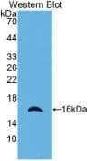 Western Blot: RAIDD/CRADD Antibody (23#) [NBP3-42110] - Western Blot; Sample: Recombinant RAIDD/CRADD, Human