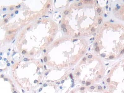 Immunohistochemistry-Paraffin: Matriptase/ST14 Antibody (C4) [NBP3-42111] - DAB staining on IHC-P; Samples: Human Kidney Tissue; Primary Ab: 20ug/ml NBP3-42111; Second Ab: 2ug/mL HRP-Linked Caprine Anti-Mouse IgG Polyclonal Antibody