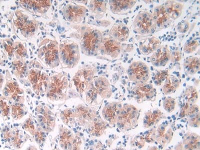 Immunohistochemistry-Paraffin: Matriptase/ST14 Antibody (C4) [NBP3-42111] - DAB staining on IHC-P; Samples: Human Stomach Tissue; Primary Ab: 20ug/ml NBP3-42111; Second Ab: 2ug/mL HRP-Linked Caprine Anti-Mouse IgG Polyclonal Antibody