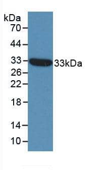 Western Blot: Matriptase/ST14 Antibody (C4) [NBP3-42111] - Sample: Recombinant Matriptase/ST14, Human.