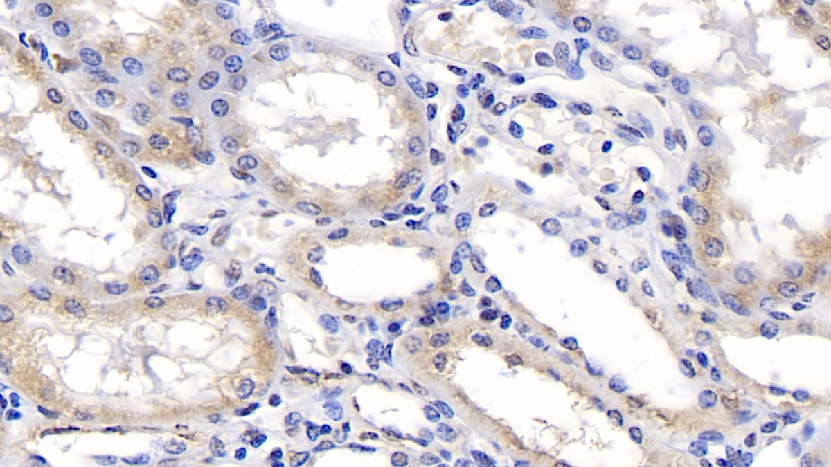 Immunohistochemistry-Paraffin: SPFH2 Antibody (C2) [NBP3-42113] - DAB staining on IHC-P; Samples: Human Kidney Tissue; Primary Ab: 40ug/ml NBP3-42113; Second Ab: 2ug/mL HRP-Linked Caprine Anti-Mouse IgG Polyclonal Antibody