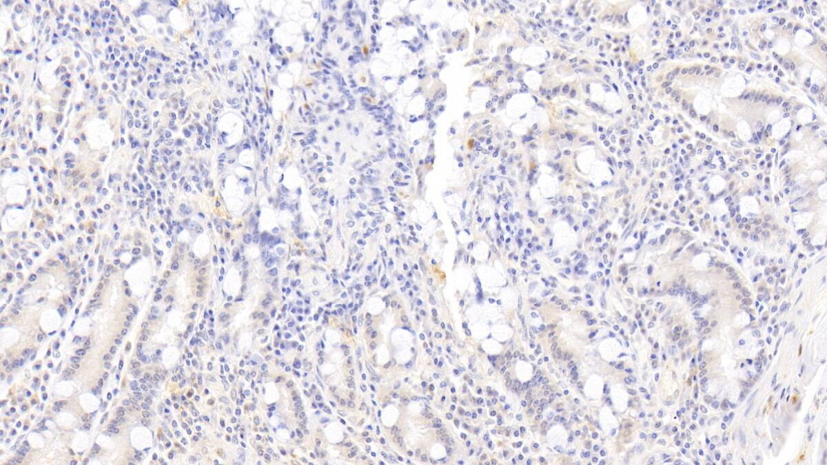 Immunohistochemistry-Paraffin: Rac1 Antibody (C1) [NBP3-42114] - DAB staining on IHC-P; Samples: Human Small intestine Tissue; Primary Ab: 30ug/ml NBP3-42114; Second Ab: 2ug/mL HRP-Linked Caprine Anti-Mouse IgG Polyclonal Antibody