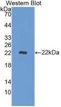 Western Blot: REV1 Antibody (10#) [NBP3-42115] - Western Blot; Sample: Recombinant REV1, Human