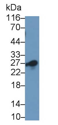 Western Blot: CD8 beta Antibody (C1) [NBP3-42116] - Sample: Human Lung lysate Primary Ab: 0.5ug/ml NBP3-42116; Second Ab: 0.2ug/mL HRP-Linked Caprine Anti-Mouse IgG Polyclonal Antibody