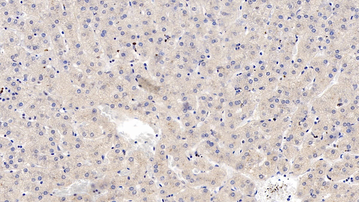 Immunohistochemistry-Paraffin: Wnt-4 Antibody (C1) [NBP3-42123] - DAB staining on IHC-P; Samples: Human Liver Tissue; Primary Ab: 10ug/ml NBP3-42123; Second Ab: 2ug/mL HRP-Linked Caprine Anti-Mouse IgG Polyclonal Antibody