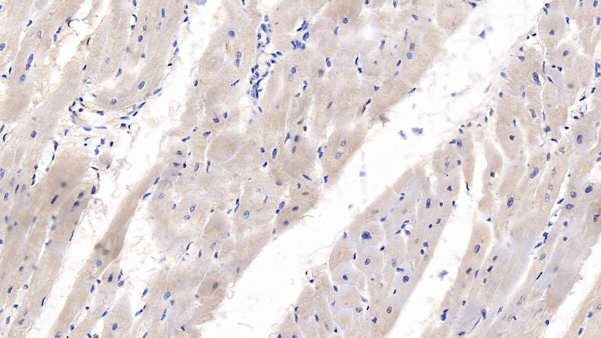 Immunohistochemistry-Paraffin: Wnt-4 Antibody (C1) [NBP3-42123] - DAB staining on IHC-P; Samples: Human Cardiac Muscle Tissue; Primary Ab: 10ug/ml NBP3-42123; Second Ab: 2ug/mL HRP-Linked Caprine Anti-Mouse IgG Polyclonal Antibody