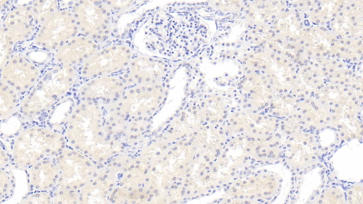 Immunohistochemistry-Paraffin: RHD Antibody (C2) [NBP3-42126] - DAB staining on IHC-P; Sample: Human Kidney Tissue; Primary Ab: 20ug/ml NBP3-42126; Second Ab: 2ug/mL HRP-Linked Caprine Anti-Mouse IgG Polyclonal Antibody