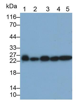 Western Blot: Gankyrin Antibody (C2) [NBP3-42131] - Sample: Lane1: Porcine Testis lysate; Lane2: A549 cell lysate; 