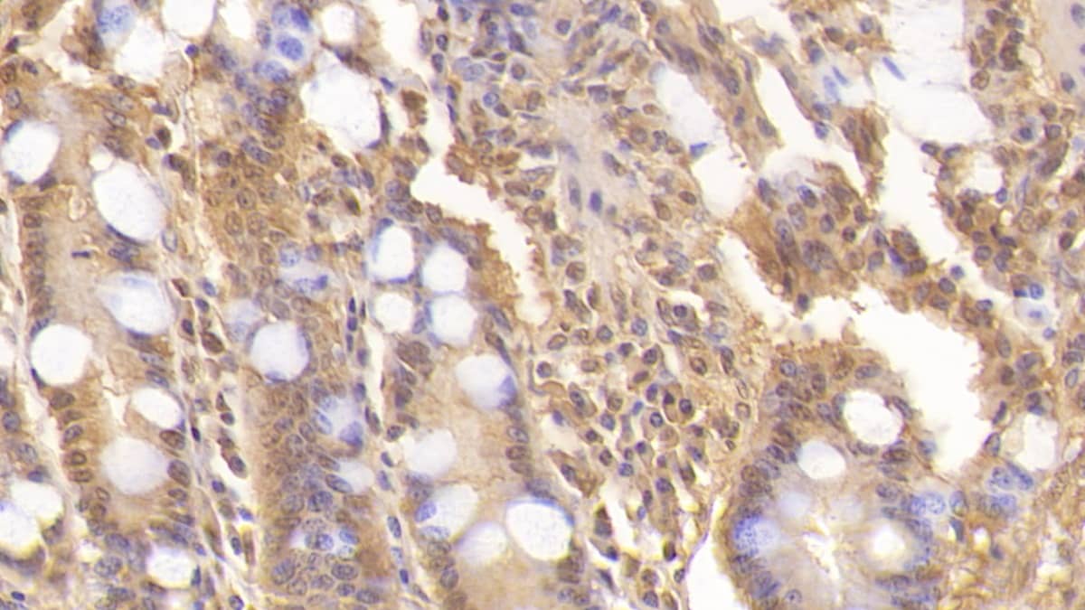 Immunohistochemistry-Paraffin: Wnt-3a Antibody (C2) [NBP3-42133] - DAB staining on IHC-P; Sample: Human Small intestine Tissue; Primary Ab: 30ug/ml NBP3-42133; Second Ab: 2ug/mL HRP-Linked Caprine Anti-Mouse IgG Polyclonal Antibody