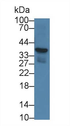 Western Blot: CRHBP Antibody (D2) [NBP3-42136] - Sample: Rat Heart lysate Primary Ab: 2ug/ml NBP3-42136; Second Ab: 0.2ug/mL HRP-Linked Caprine Anti-Mouse IgG Polyclonal Antibody