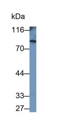 Western Blot: PDE4B Antibody (C1) [NBP3-42140] - Sample: Rat Cerebrum lysate Primary Ab: 0.2ug/ml NBP3-42140; Second Ab: 0.2ug/mL HRP-Linked Caprine Anti-Mouse IgG Polyclonal Antibody