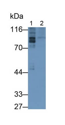 Western Blot: PDE4B Antibody (C10) [NBP3-42141] - Sample: Lane1: Rat Cerebrum lysate; Lane2: Rat Cerebellum lysate Primary Ab: 0.2ug/ml NBP3-42141; Second Ab: 0.2ug/mL HRP-Linked Caprine Anti-Mouse IgG Polyclonal Antibody