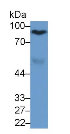 Western Blot: Afamin Antibody (C10) [NBP3-42144] - Sample: Rat Serum Primary Ab: 2ug/ml NBP3-42144; Second Ab: 0.2ug/mL HRP-Linked Caprine Anti-Mouse IgG Polyclonal Antibody