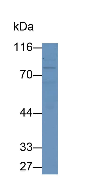 Western Blot: MxA/Mx1 Antibody (C10) [NBP3-42148] - Sample: Human Lung lysate Primary Ab: 2ug/ml NBP3-42148; Second Ab: 0.2ug/ml HRP-Linked Caprine Anti-Mouse IgG Polyclonal Antibody